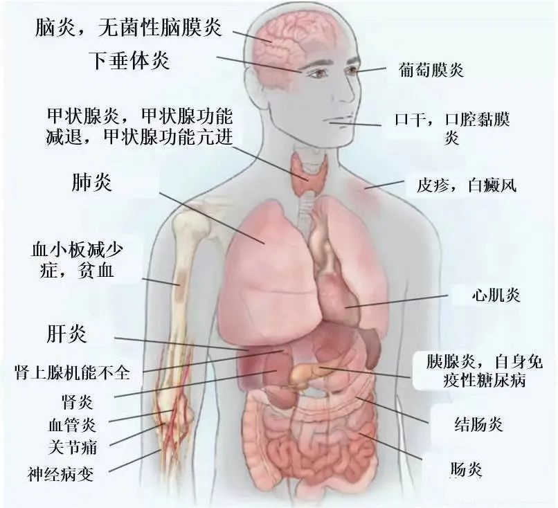 免疫治疗毒性常见发病位置