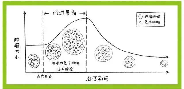 免疫治疗假进展