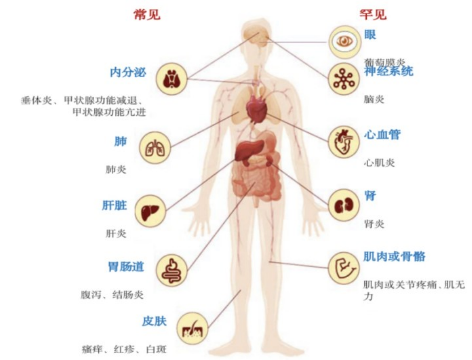 免疫治疗的副作用