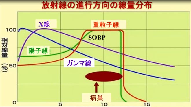 胃癌质子重离子治疗需要几个疗程