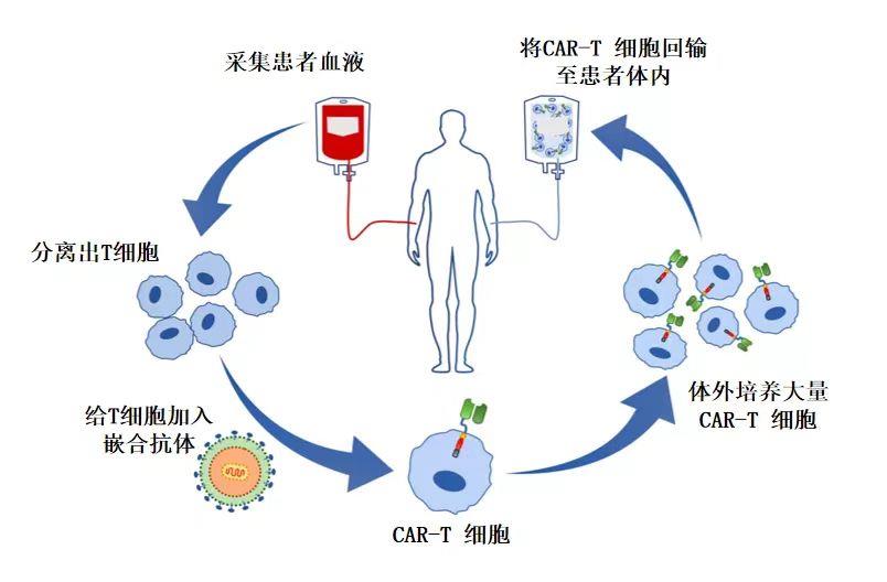 CAR-T治疗流程